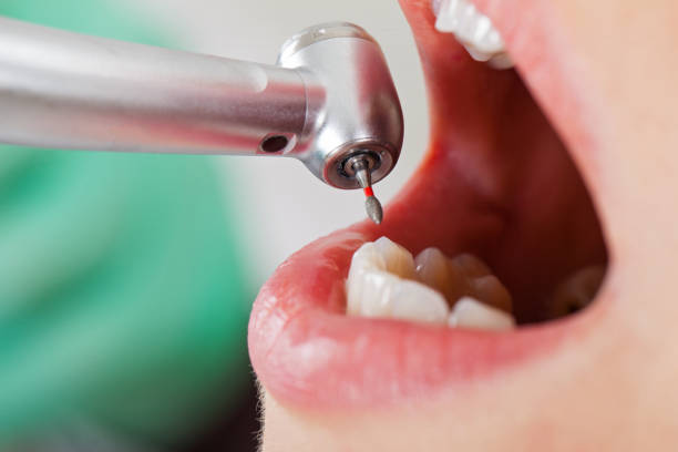 Best Emergency Dentist for Lost Fillings or Crowns in Boothwyn, PA